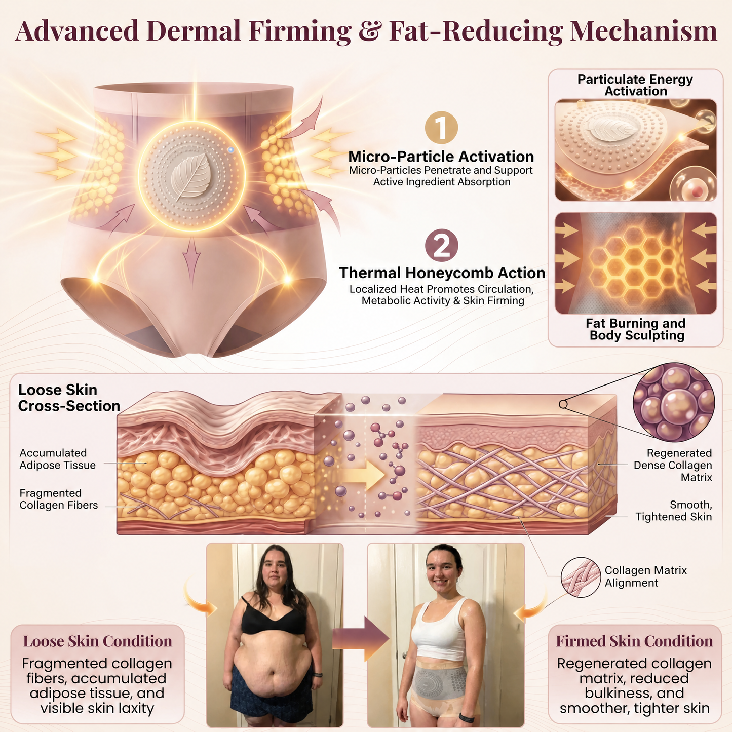MICRO-PARTICLE SCULPTING & FAT-BURN SHORTS VIP